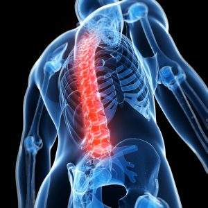 Spine Injury, Spinal Cord Injury